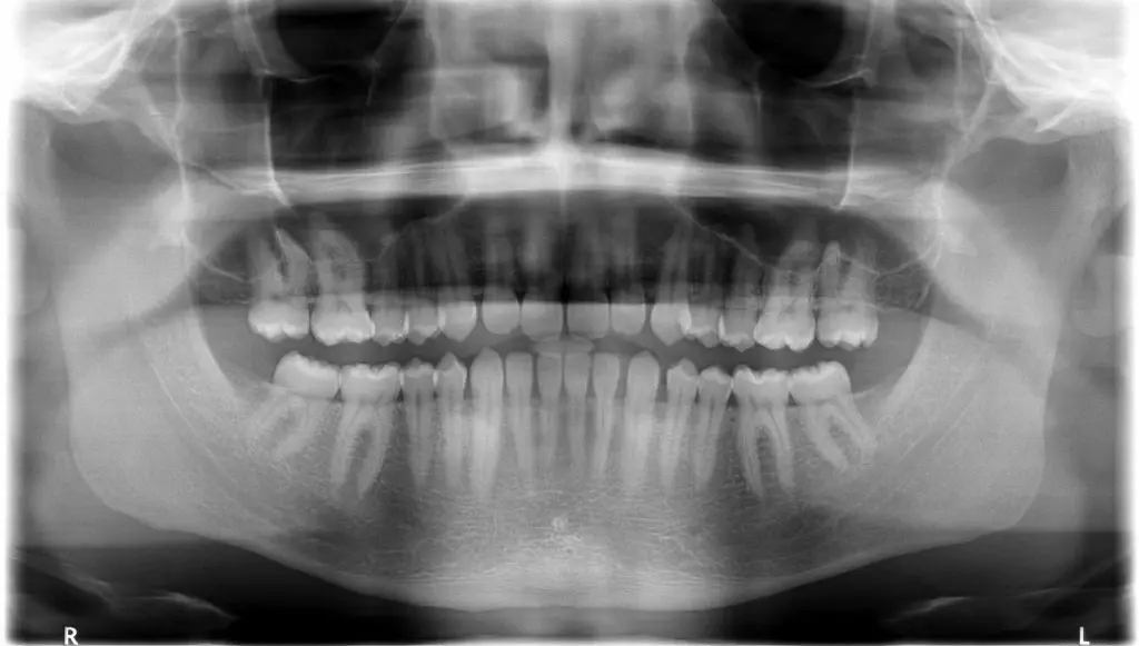 Orthopantomograms