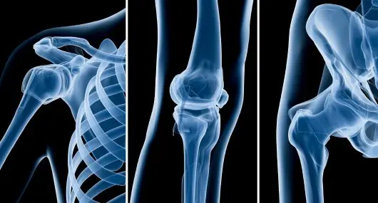 Orthopedics
