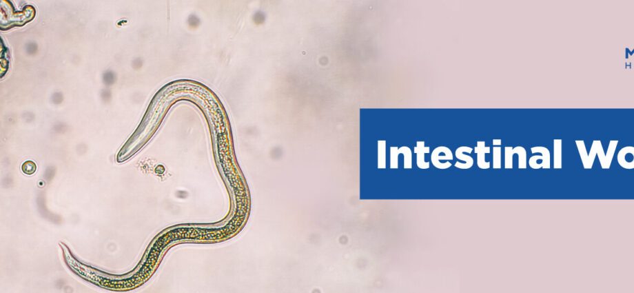 A opinião do nosso médico sobre vermes intestinais