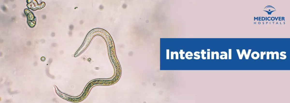 Our doctor&#8217;s opinion about intestinal worms