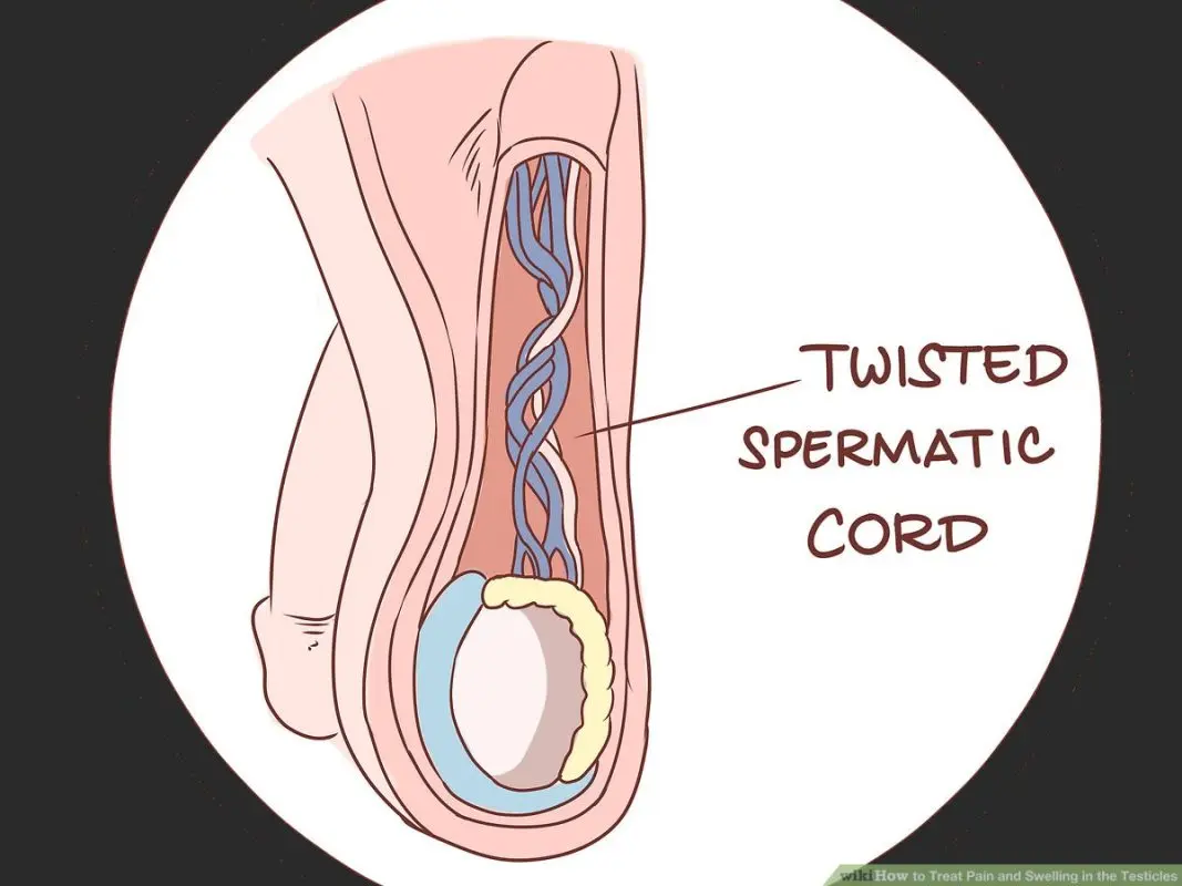 Pain and swelling of the testicles