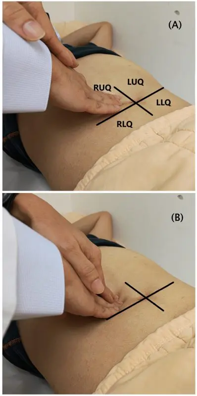 Palpation