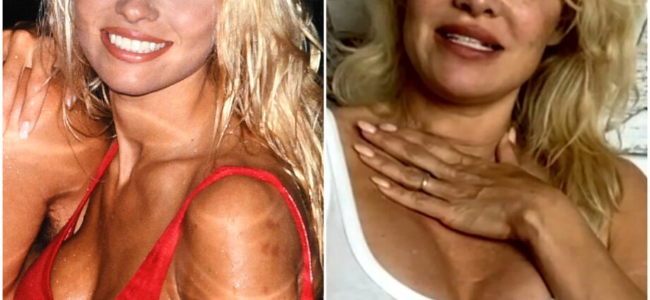 Pamela Anderson ro agus às deidh dealbh lannsaireachd plastaig
