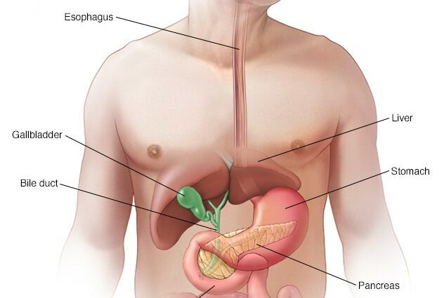 kanker Pancreatic