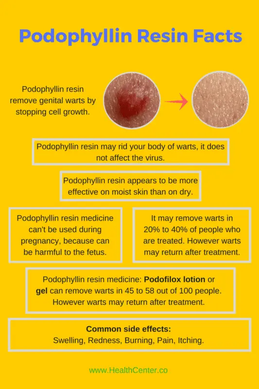 Papillomas appeared during pregnancy, removal of papillomas