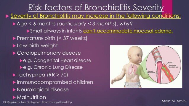 လူများနှင့် bronchiolitis အတွက်အန္တရာယ်အချက်များ