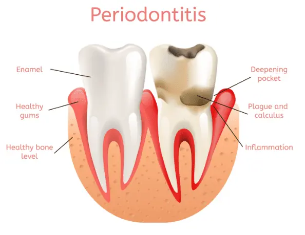 Periodontics