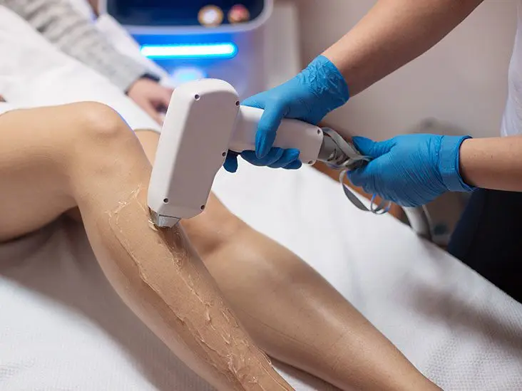 Permanent hair removal: all you need to know about laser hair removal