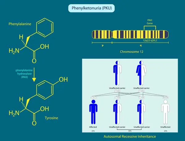 Phenylketonuria