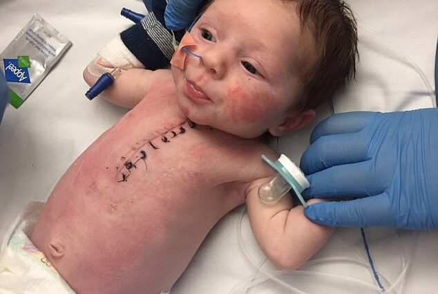 Photos of a seven-day-old baby after heart surgery hit the network