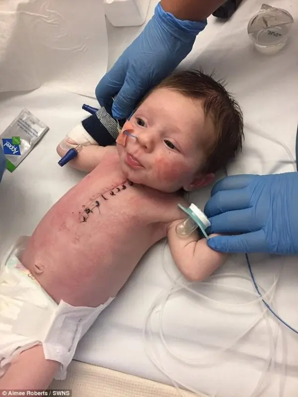 Photos of a seven-day-old baby after heart surgery hit the network