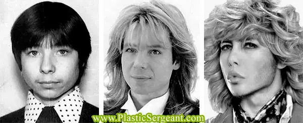 Plastic surgery by Sergey Zverev, before and after photos