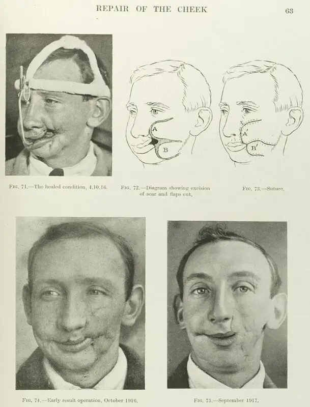 Plastic surgery: history and details