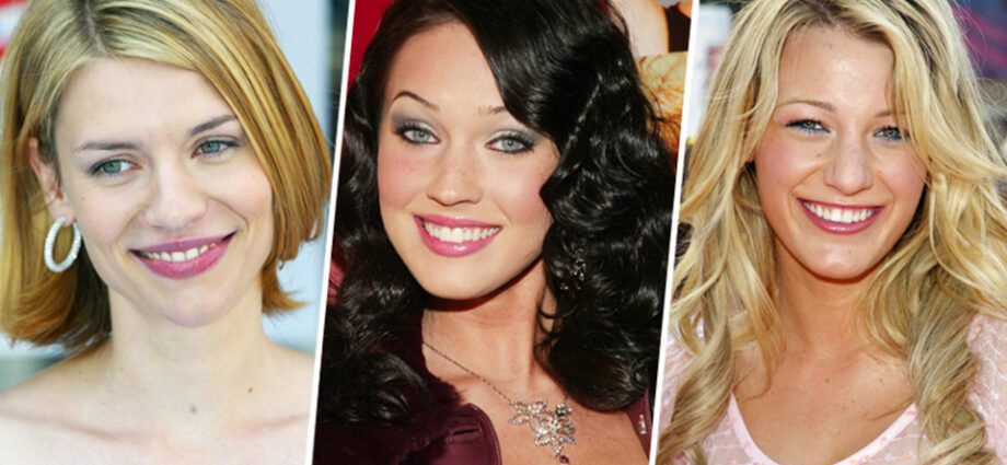 Stars before and after lip plastics photos