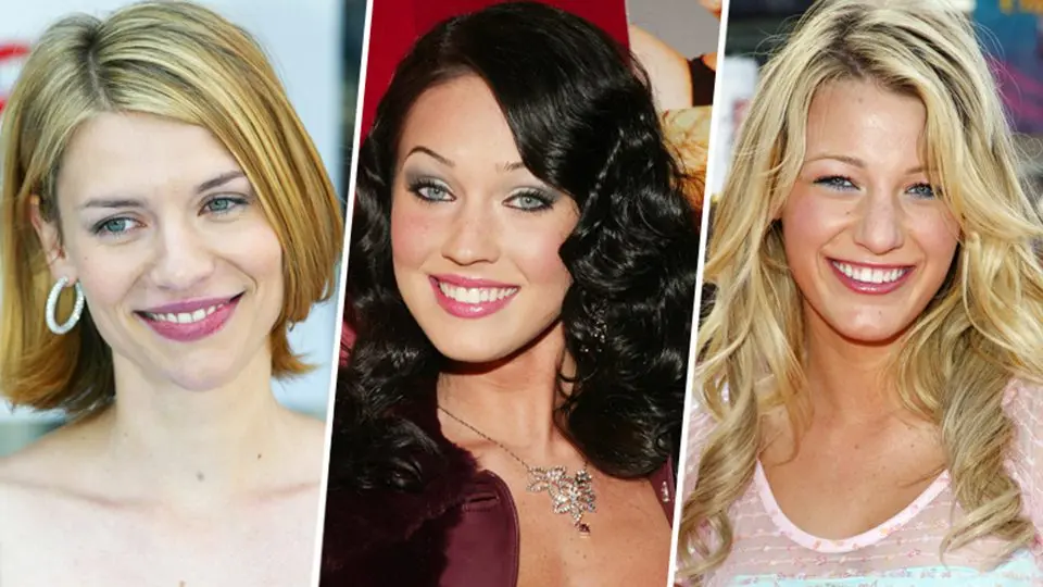 Stars before and after lip plastics photos