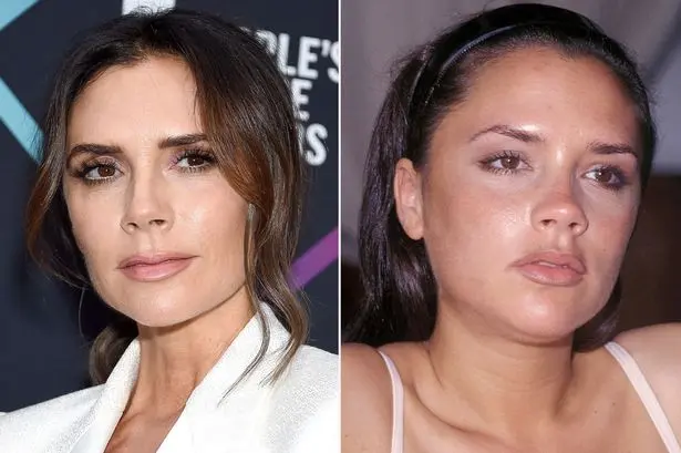 Plastic surgery stars: Victoria Beckham