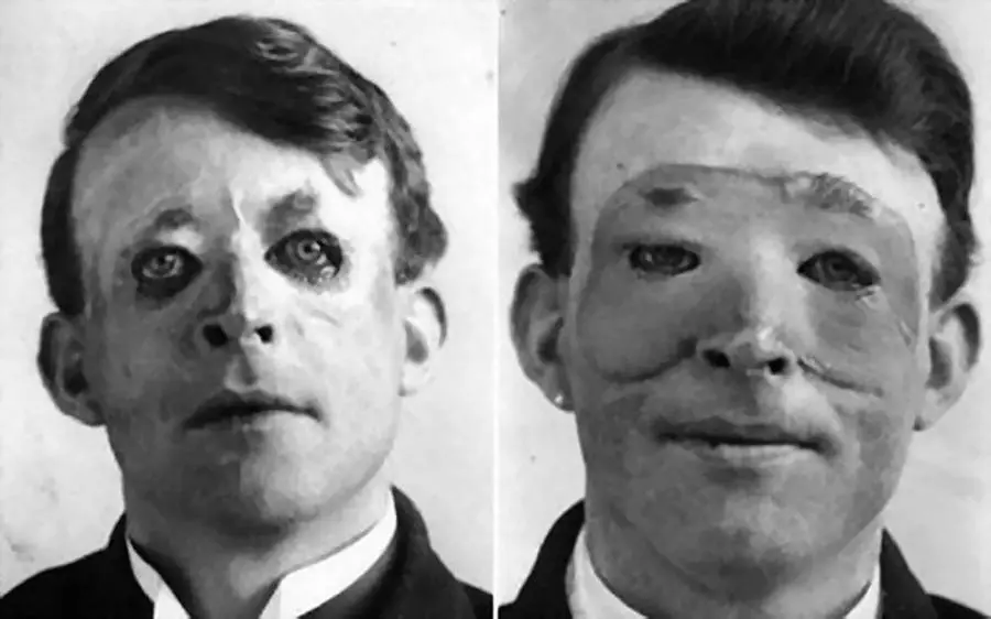 Plastic surgery victims before and after