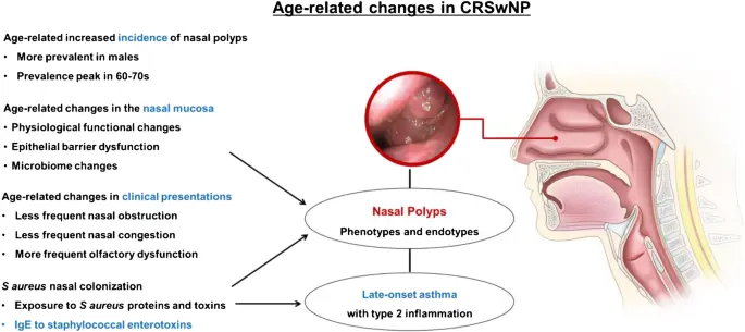 Polyp: what are the characteristics of nose, bladder and colon polyps?