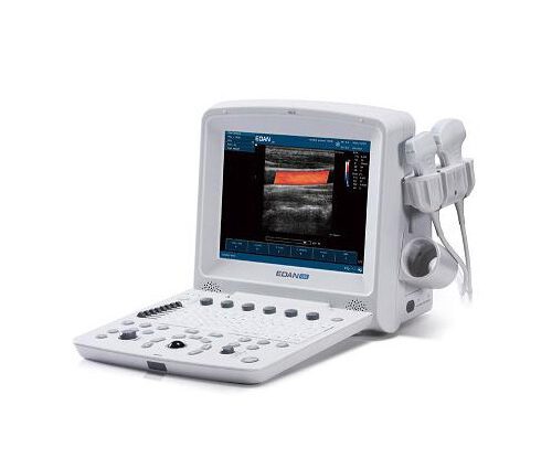 Portable ultrasound machine: what is it for, how to use it?