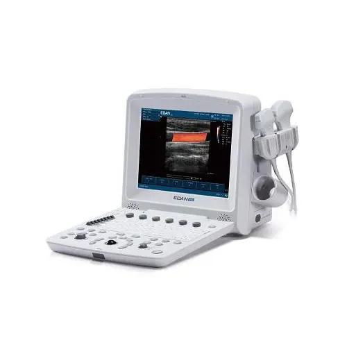 Portable ultrasound machine: what is it for, how to use it?