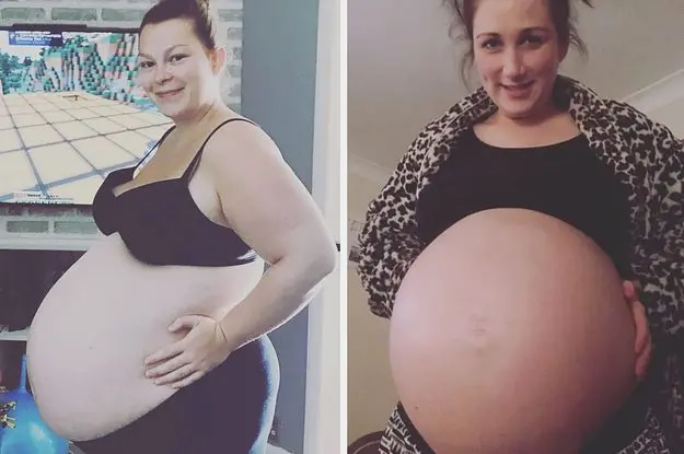 Pregnant triplets showed belly, belly with multiple pregnancy