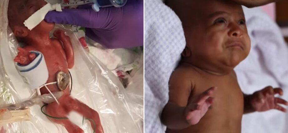 Premature baby survived despite doctors&#8217; predictions: details