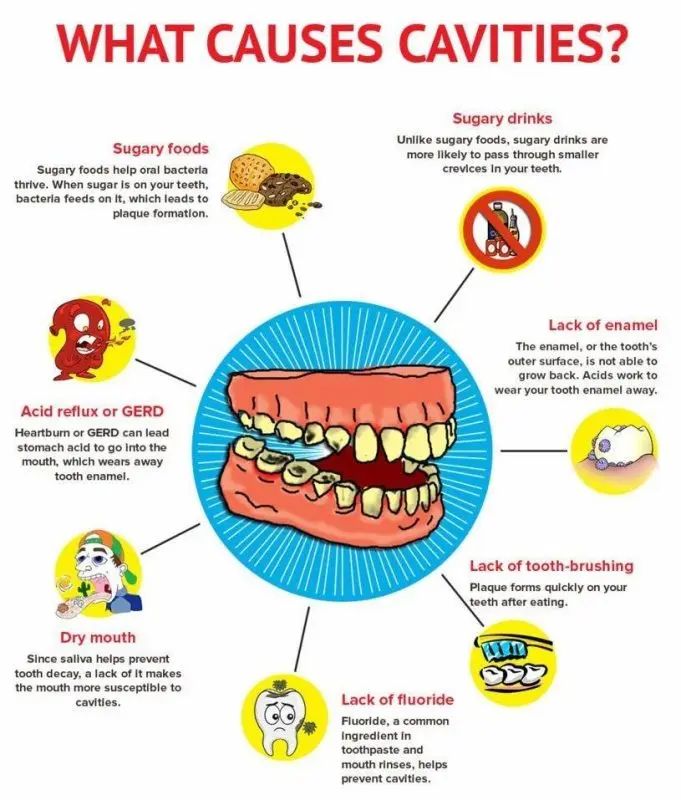 Prevention and treatment of cavities