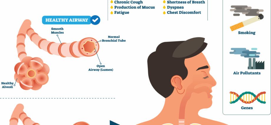 Prevention of chronic bronchitis and emphysema (COPD)