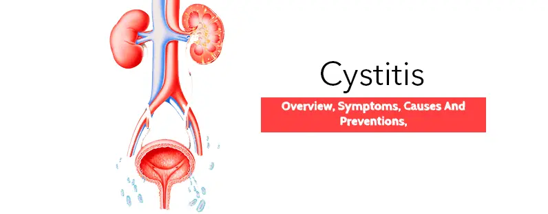 Prevention of cystitis in winter