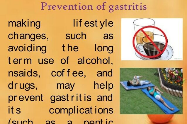 Πρόληψη της γαστρίτιδας