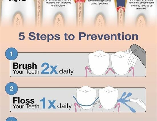 Prevention of periodontitis