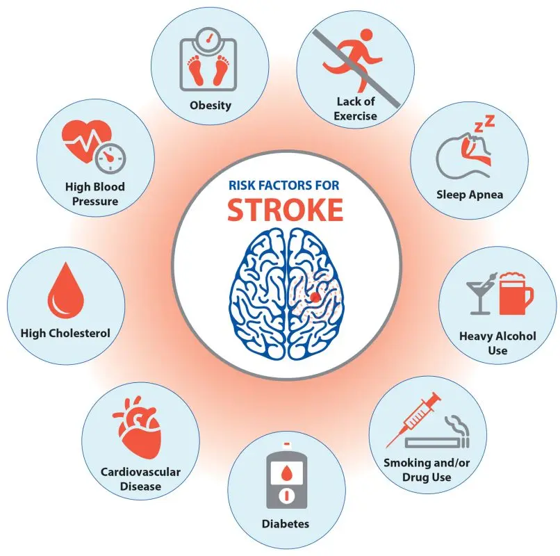 Prevention of stroke