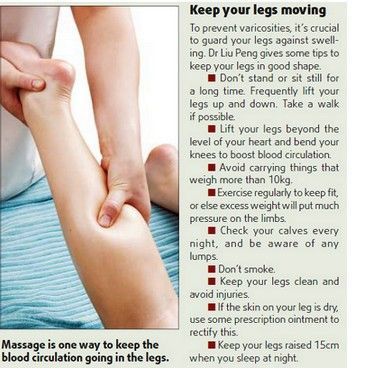 Prevention of varicose veins: how to keep your legs healthy?