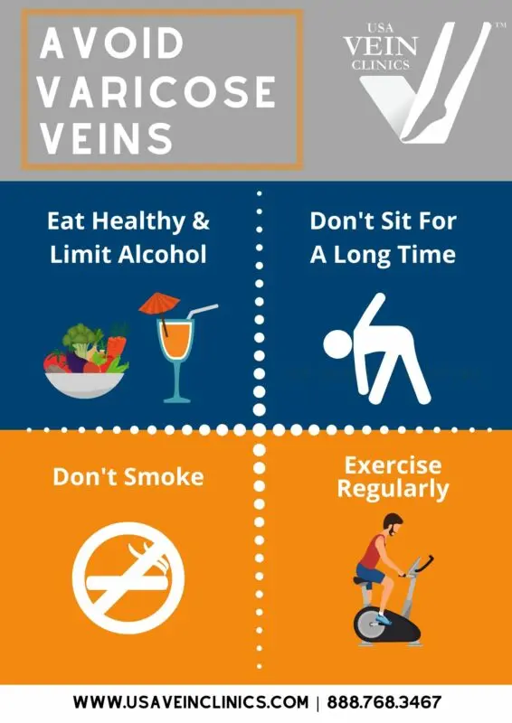 Prevention of varicose veins