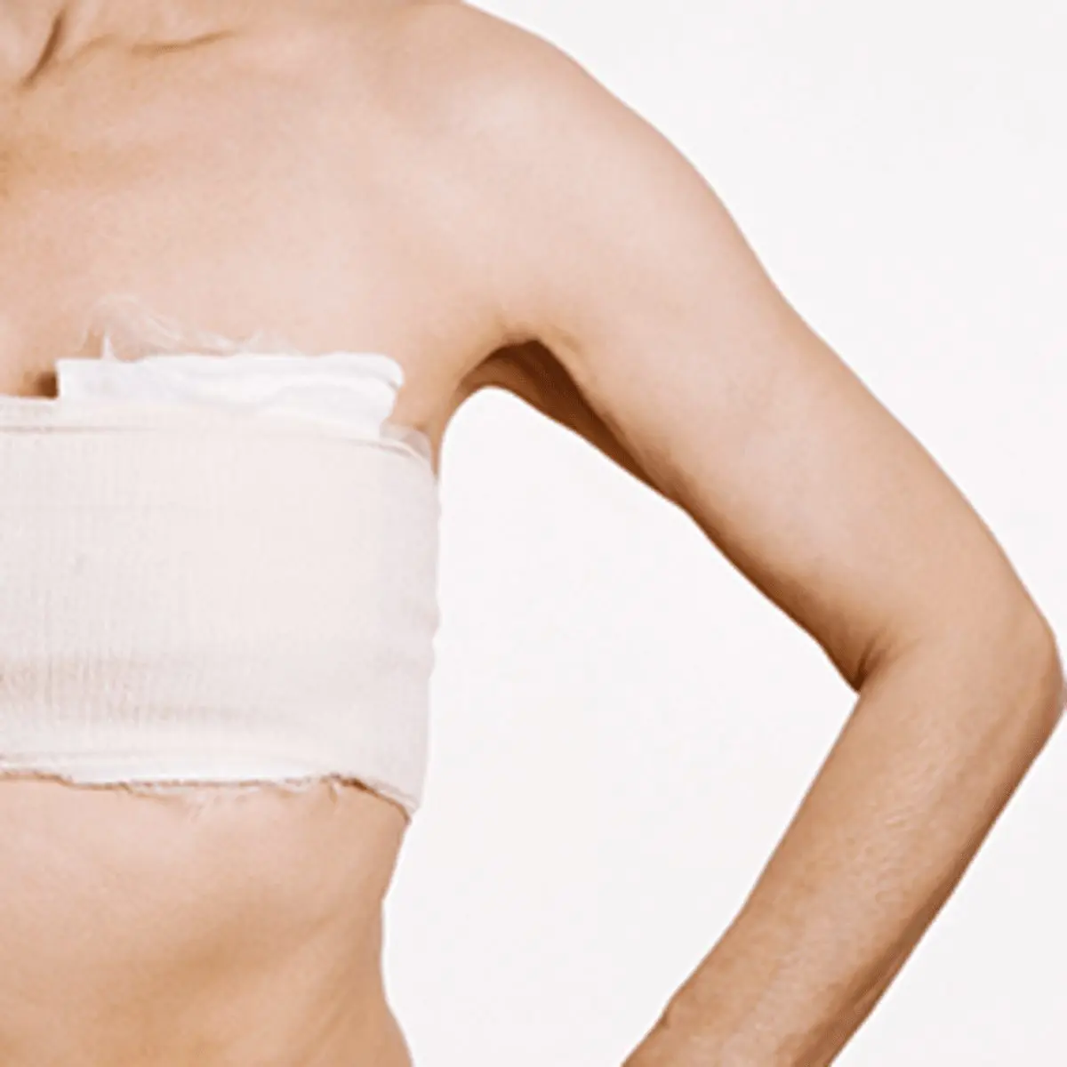 Preventive mastectomy against breast cancer