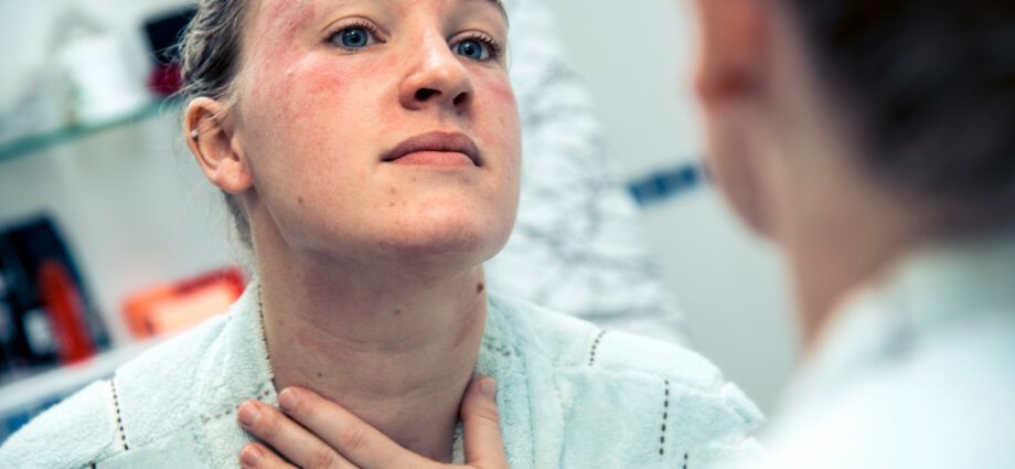 Rash on the skin of the face during pregnancy