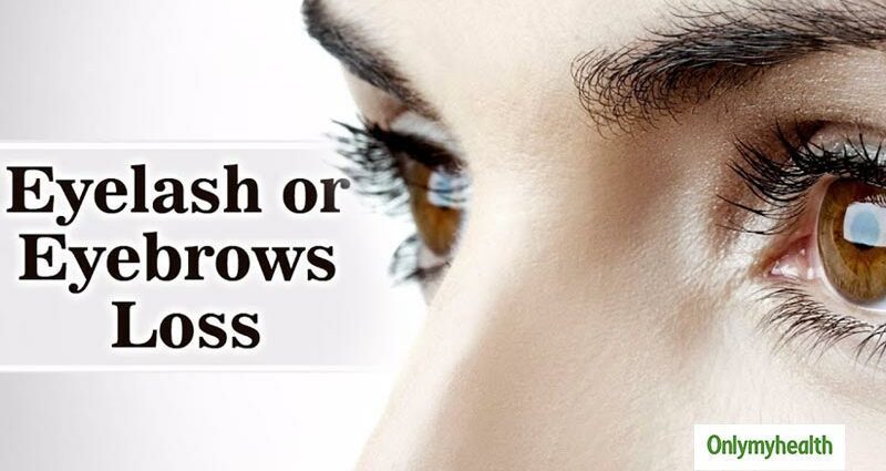 Reasons why eyebrows deteriorate: expert advice