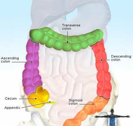 Rectorragia: causes and treatments of blood in the stool