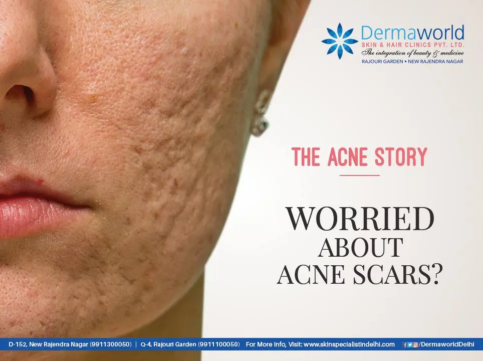 Red acne spots: skin regeneration. Video