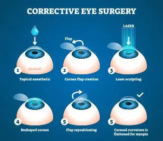 Refractive surgery