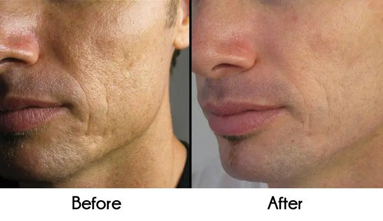 Rejuvenating facial treatments for men