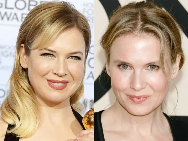 René Zellweger after plastic: photo