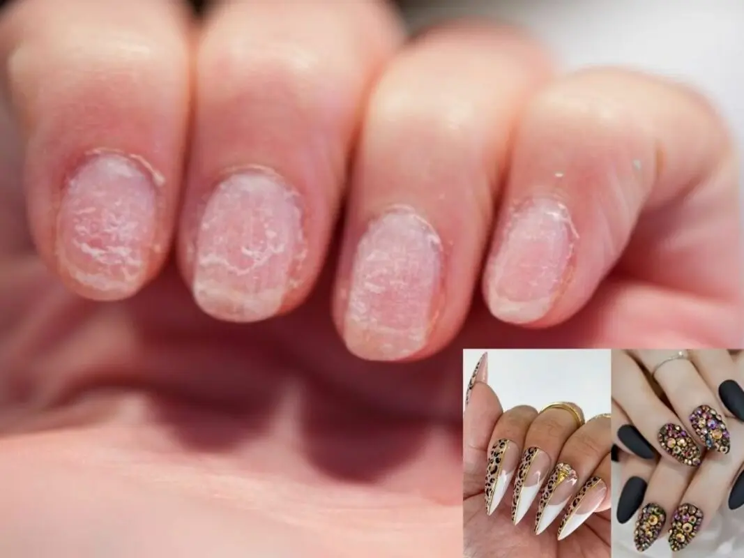 Restoration of nails after extension: photo and video