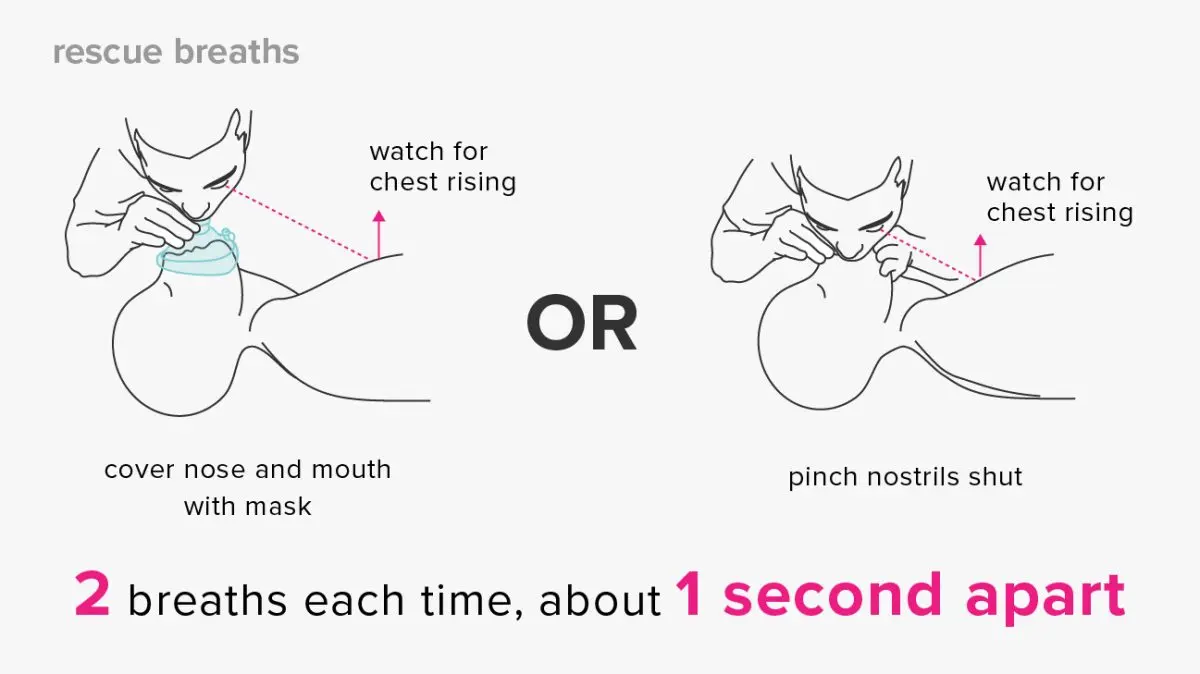 Resuscitation respirator: how does it work?