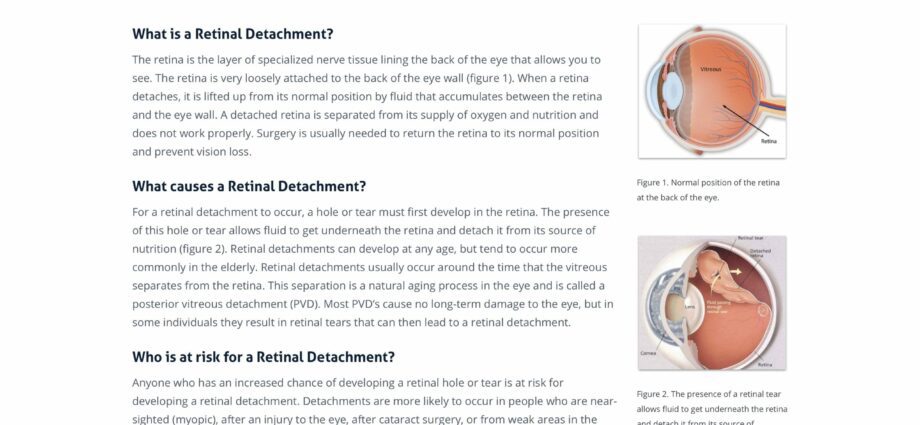 Desprinderea retinei: cauze, simptome, tratament
