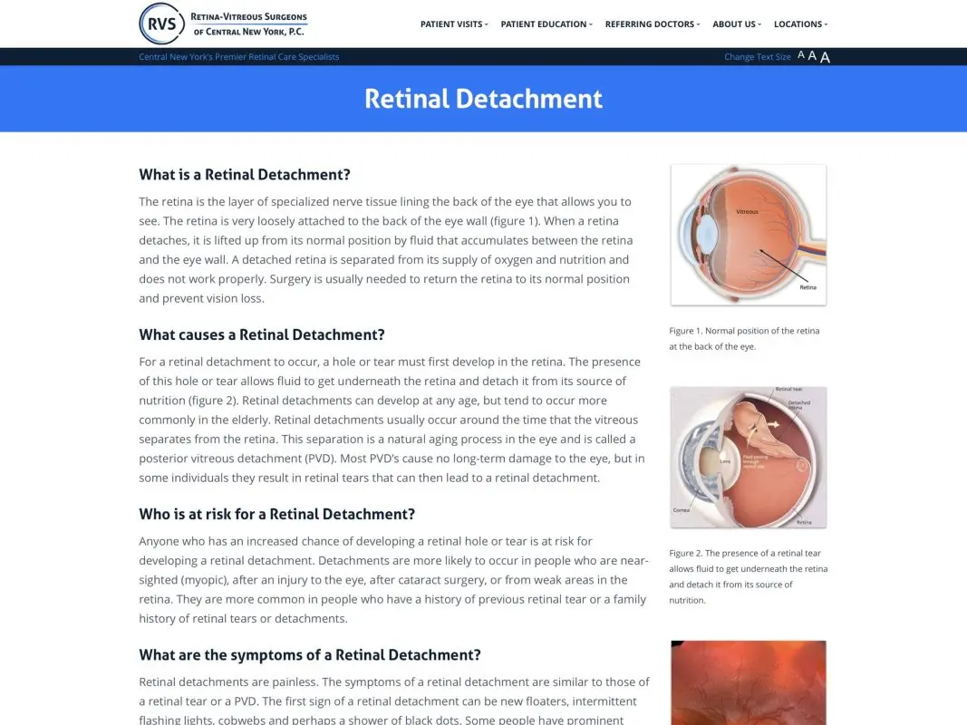 Retinal detachment: causes, symptoms, treatment