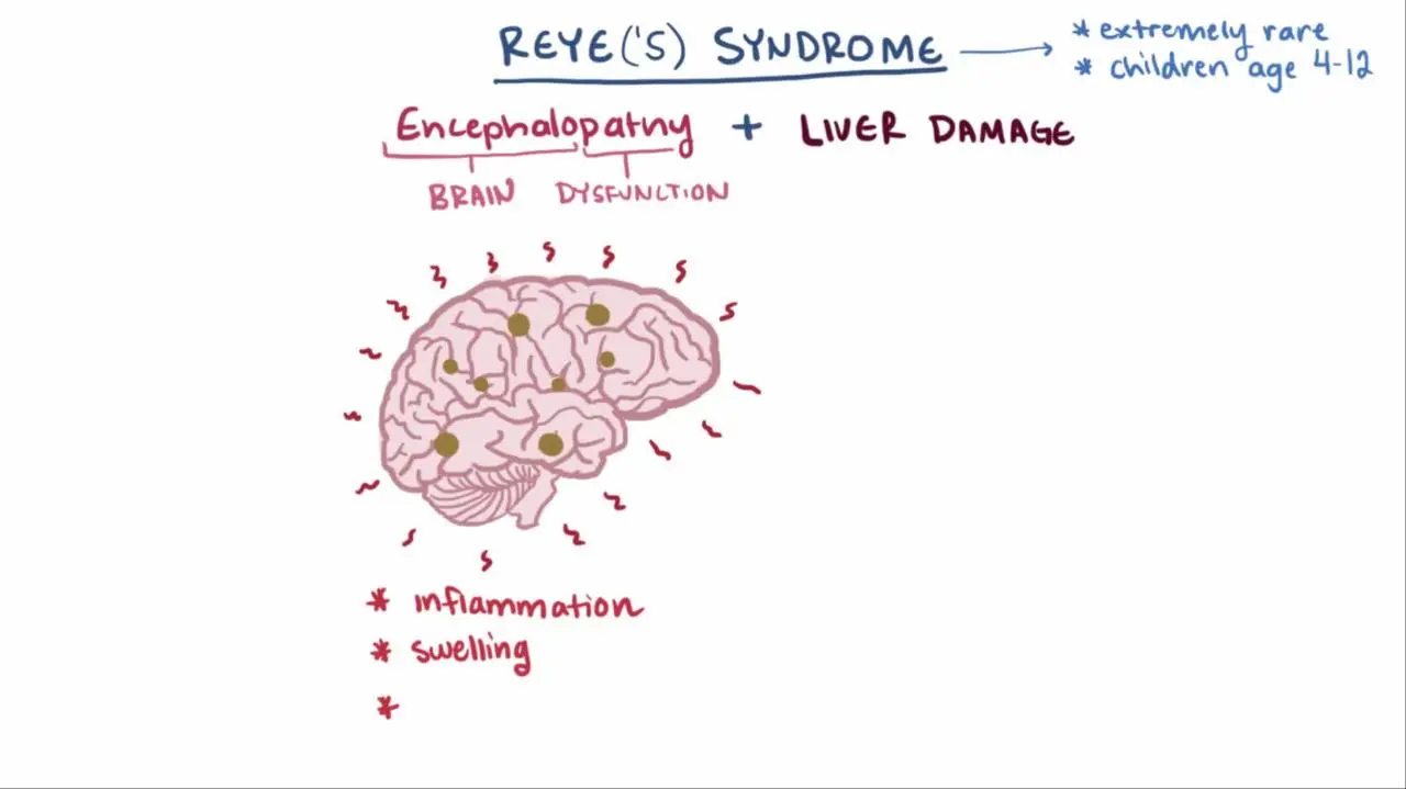 Reye syndrome