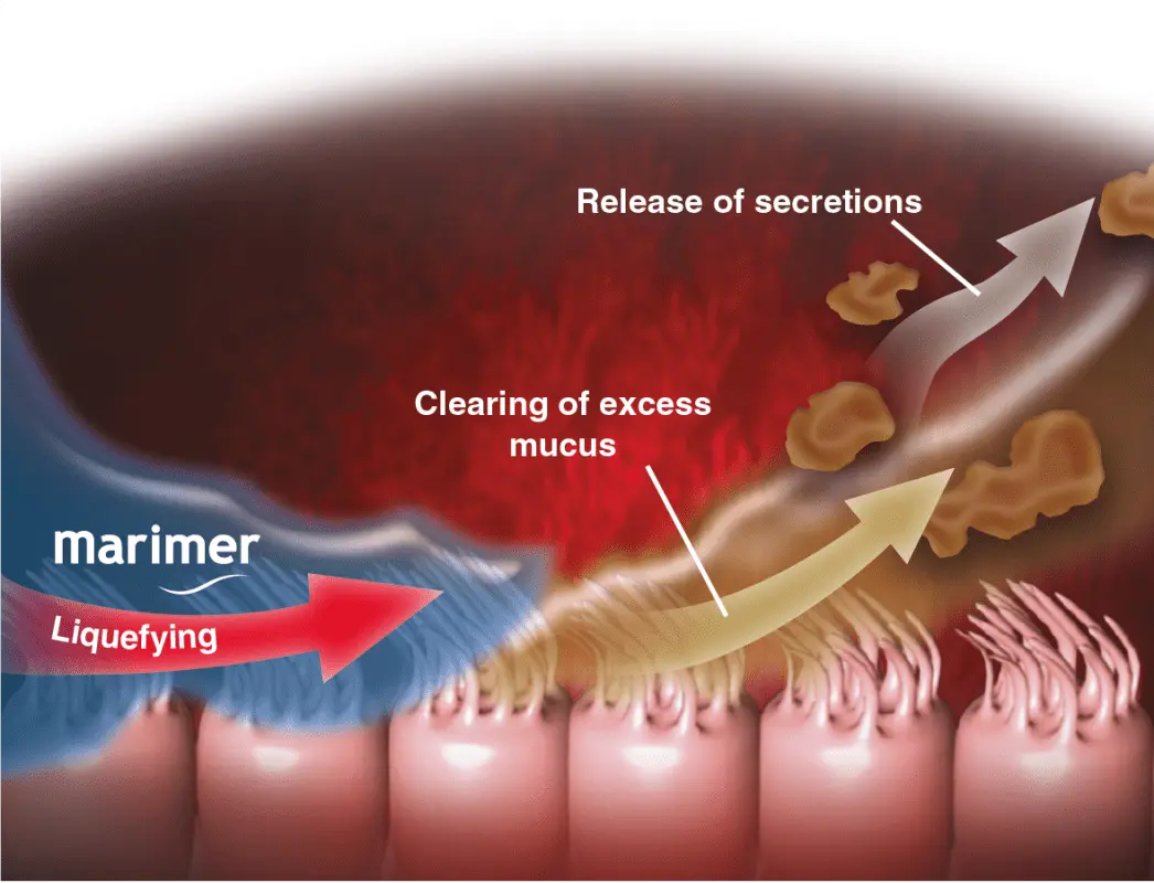 Rhinopharyngitis &#8211; Sites of interest