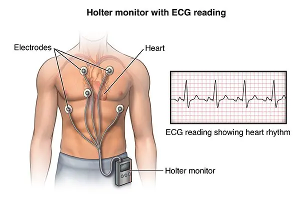 Rhythmic Holter: how does it work?