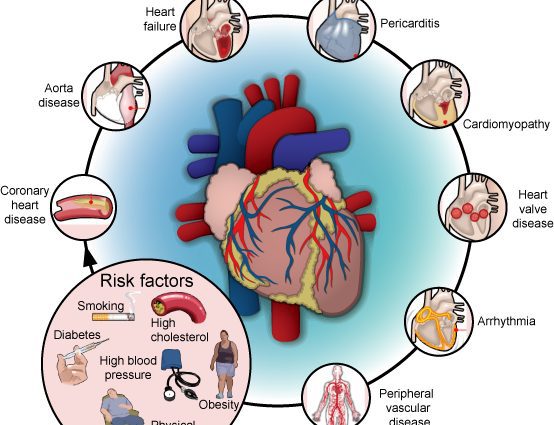 Risk factors for heart problems, cardiovascular diseases (angina and heart attack)